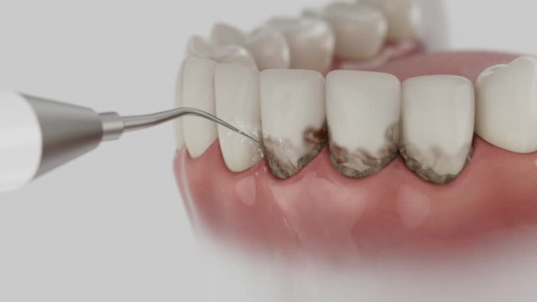 Trusted Dental Implants service in South Riding, VA - Dentist Open Now